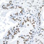 53BP1 Antibody in Immunohistochemistry (Paraffin) (IHC (P))