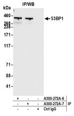 53BP1 Antibody in Immunoprecipitation (IP)