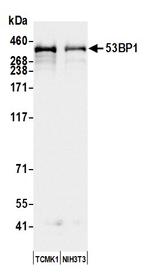 53BP1 Antibody in Western Blot (WB)