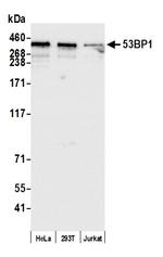 53BP1 Antibody in Western Blot (WB)