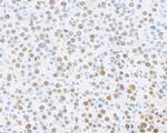 PCNA Antibody in Immunohistochemistry (Paraffin) (IHC (P))