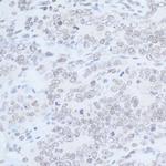 Rad6 Antibody in Immunohistochemistry (Paraffin) (IHC (P))