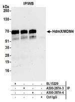 HdmX/MDM4 Antibody in Immunoprecipitation (IP)