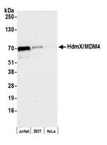 HdmX/MDM4 Antibody in Western Blot (WB)