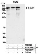 hSET1 Antibody in Immunoprecipitation (IP)