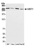 hSET1 Antibody in Western Blot (WB)