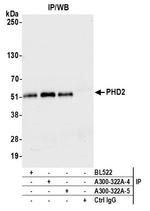 PHD2 Antibody in Immunoprecipitation (IP)