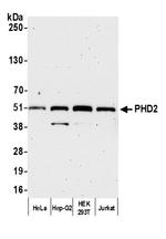 PHD2 Antibody in Western Blot (WB)