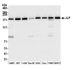 JLP Antibody in Western Blot (WB)