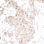 p300 Antibody in Immunohistochemistry (Paraffin) (IHC (P))