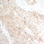 NAMPT/PBEF/Visfatin Antibody in Immunohistochemistry (Paraffin) (IHC (P))