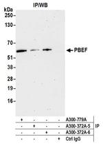 NAMPT/PBEF/Visfatin Antibody in Immunoprecipitation (IP)