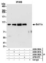 Bcl11a Antibody in Immunoprecipitation (IP)