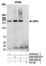 XRN1 Antibody in Immunoprecipitation (IP)