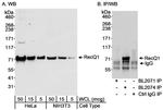 RecQ1 Antibody in Western Blot (WB)