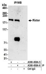 Rictor Antibody in Immunoprecipitation (IP)