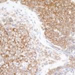 DDX3 Antibody in Immunohistochemistry (Paraffin) (IHC (P))