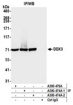 DDX3 Antibody in Immunoprecipitation (IP)