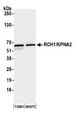 RCH1/KPNA2 Antibody in Western Blot (WB)