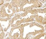 Cytoskeletal Actin Antibody in Immunohistochemistry (Paraffin) (IHC (P))