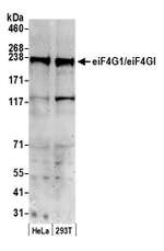 eIF4G1/eIF4GI Antibody in Western Blot (WB)