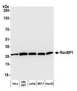 RanBP1 Antibody in Western Blot (WB)