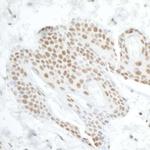 DDX5 Antibody in Immunohistochemistry (Paraffin) (IHC (P))