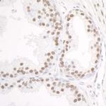 DDX5 Antibody in Immunohistochemistry (Paraffin) (IHC (P))