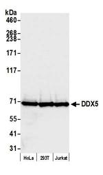 DDX5 Antibody in Western Blot (WB)