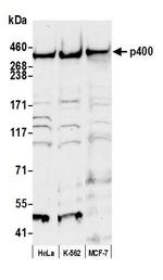 p400 Antibody in Western Blot (WB)