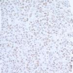 EDD1 Antibody in Immunohistochemistry (Paraffin) (IHC (P))