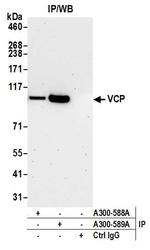 VCP Antibody in Immunoprecipitation (IP)