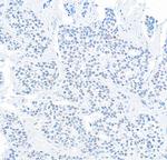 DEC1 Antibody in Immunohistochemistry (Paraffin) (IHC (P))
