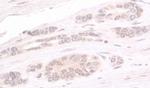 ATRIP Antibody in Immunohistochemistry (Paraffin) (IHC (P))