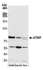 ATRIP Antibody in Western Blot (WB)