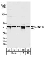 hnRNP-K Antibody in Western Blot (WB)