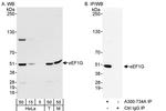 eEF1G Antibody in Western Blot (WB)