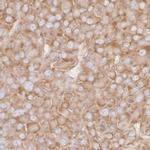 RPL7 Antibody in Immunohistochemistry (Paraffin) (IHC (P))