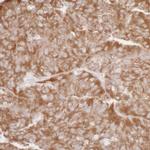 RPL7 Antibody in Immunohistochemistry (Paraffin) (IHC (P))