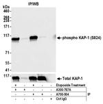 Phospho-KAP-1 (Ser824) Antibody in Immunoprecipitation (IP)