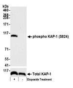 Phospho-KAP-1 (Ser824) Antibody in Western Blot (WB)