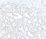 MED12 Antibody in Immunohistochemistry (Paraffin) (IHC (P))