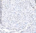 MED12 Antibody in Immunohistochemistry (Paraffin) (IHC (P))