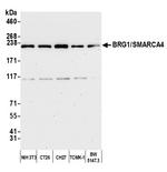 BRG1/SMARCA4 Antibody in Western Blot (WB)