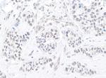 TIF1 Alpha/TRIM24 Antibody in Immunohistochemistry (Paraffin) (IHC (P))