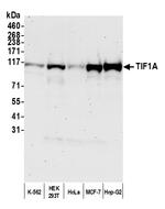 TIF1 Alpha/TRIM24 Antibody in Western Blot (WB)