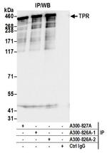 TPR Antibody in Immunoprecipitation (IP)