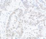 TPR Antibody in Immunohistochemistry (Paraffin) (IHC (P))