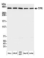 TPR Antibody in Western Blot (WB)