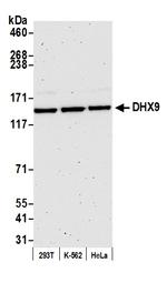 DHX9 Antibody in Western Blot (WB)